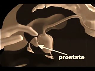 Prostata-massage-techniken